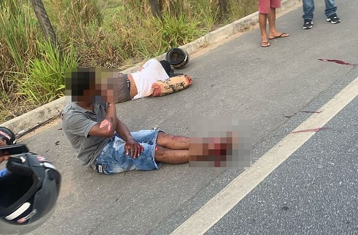 Motociclista tem parte da perna amputada em acidente na BR-104, em Murici