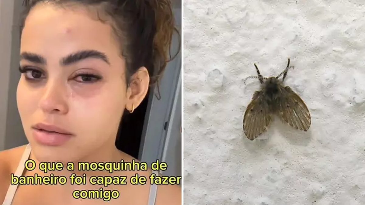 Jovem vai parar no médico após mosca entrar no olho: 'Desesperada'