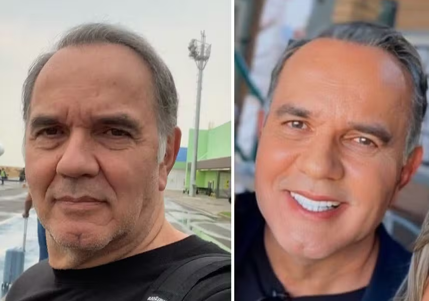Humberto Martins celebra harmonização facial: 'Estava preocupado, mas deu certo'