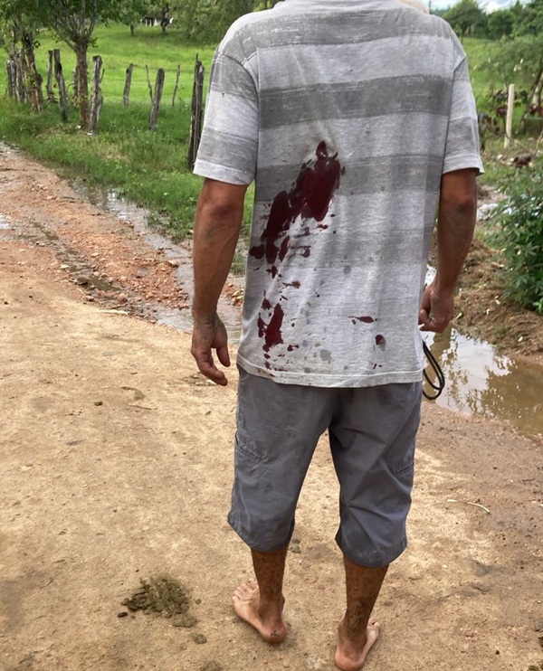 Homem é esfaqueado após desentendimento na zona rural de Palmeira dos Índios