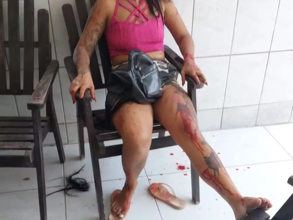 Mulher feriu o próprio corpo para simular sequestro no Recife