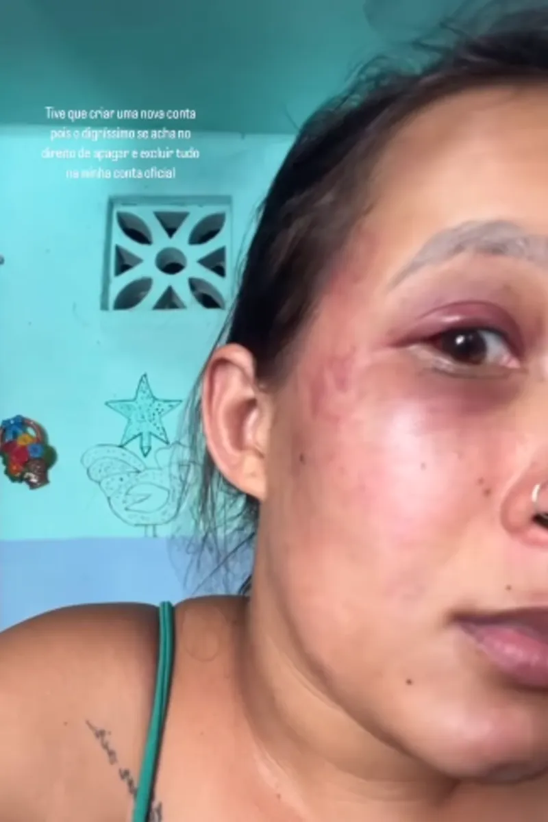 Recusou sexo e foi espancada: mulher denuncia companheiro por agressão no Tabuleiro