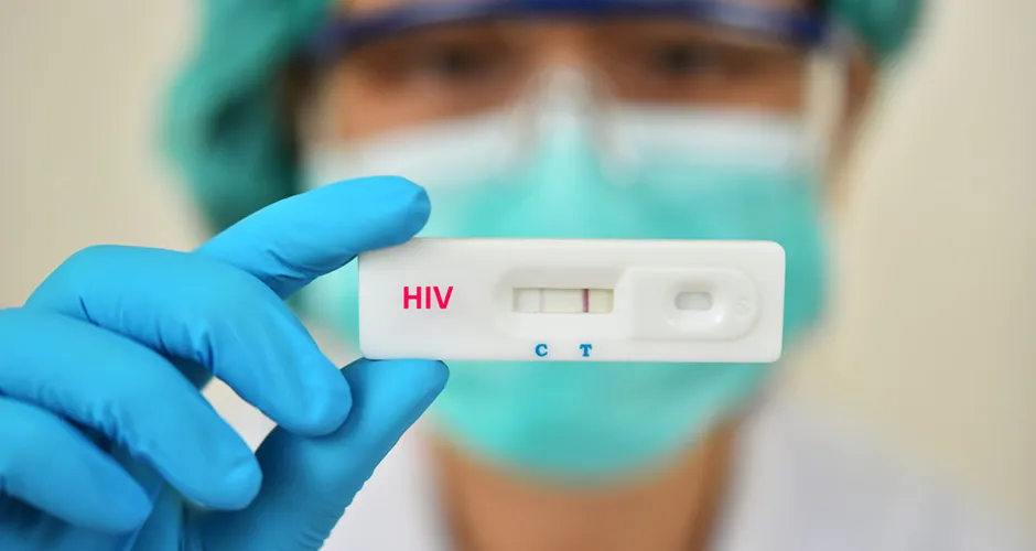 Maceió registra 226 casos de HIV este ano, segundo dados da SMS