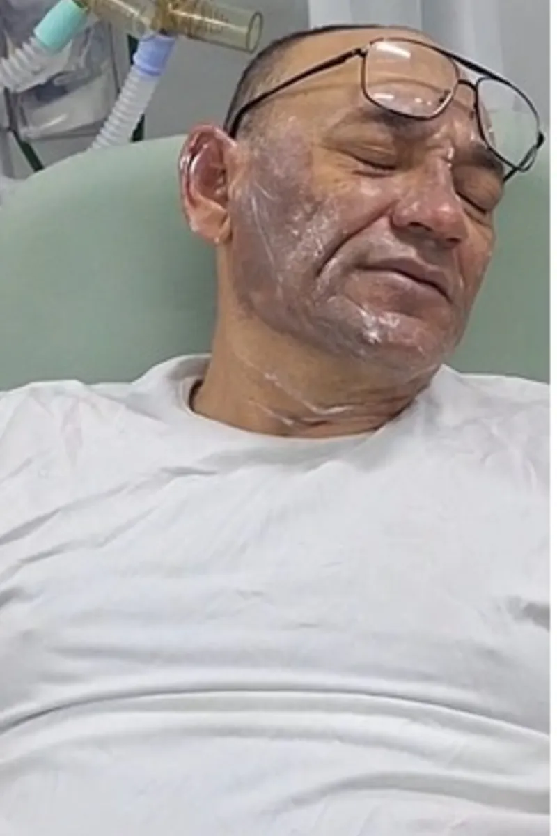 Sargento da PM é atingido com óleo quente no rosto ao prestar apoio à ocorrência com paciente psiquiátrico