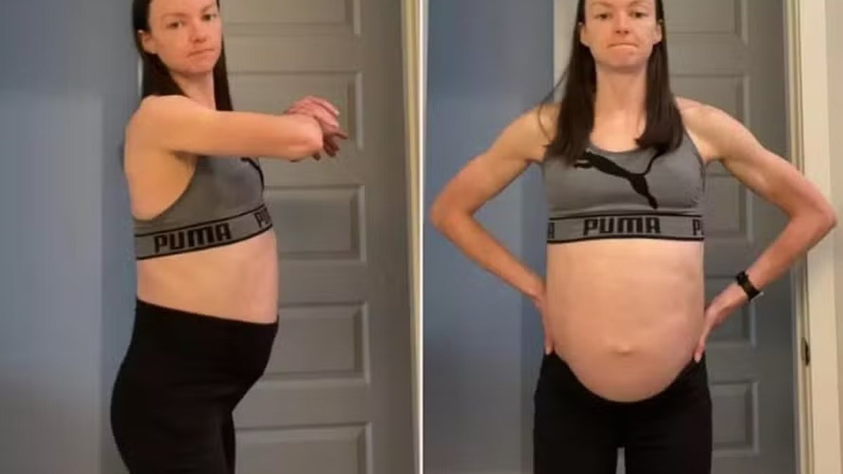 Mulher com pavor de médico descobre cisto gigante após ficar anos longe de consultórios