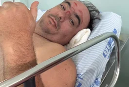 Prefeito de Junqueiro tranquiliza população após acidente durante vaquejada