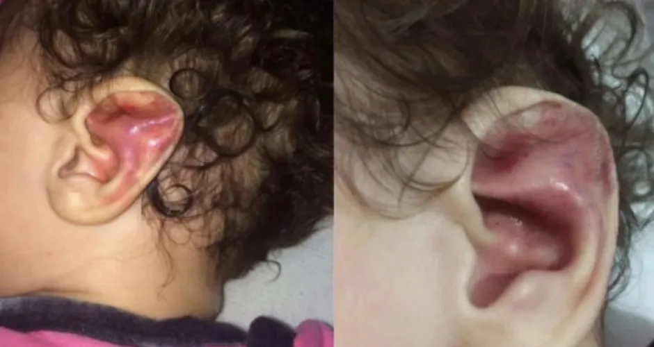 Mãe é presa após torturar e quebrar 6 costelas de filha bebê