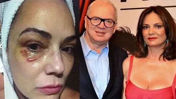 Luiza Brunet pede R$ 1 milhão de indenização de ex-marido por agressão