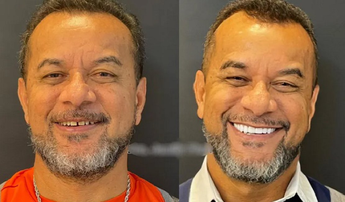 Luiz Carlos das Dores, de 56 anos, após fazer as facetas dentárias - Foto: Reprodução/TV Anhanguera