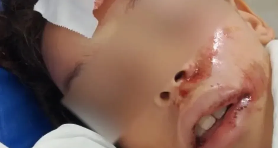 Crianças denunciam agressões em Maceió, e polícia investiga 2 casos graves