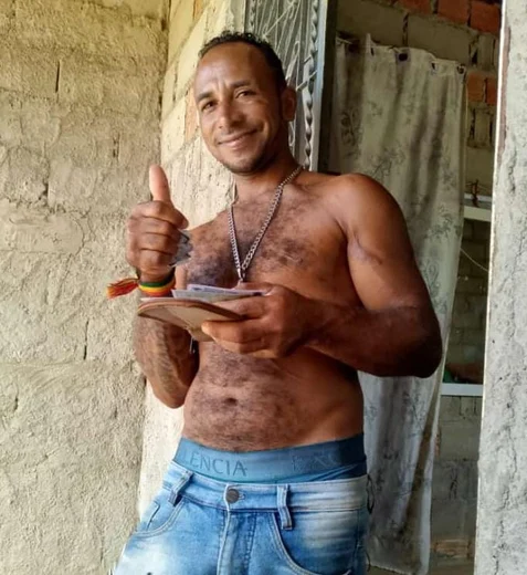 Homem é encontrado morto após sofrer traumatismo craniano, em Alagoas