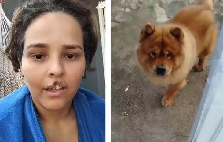 Cachorro que mordeu e arrancou lábio de tutora é submetido à eutanásia