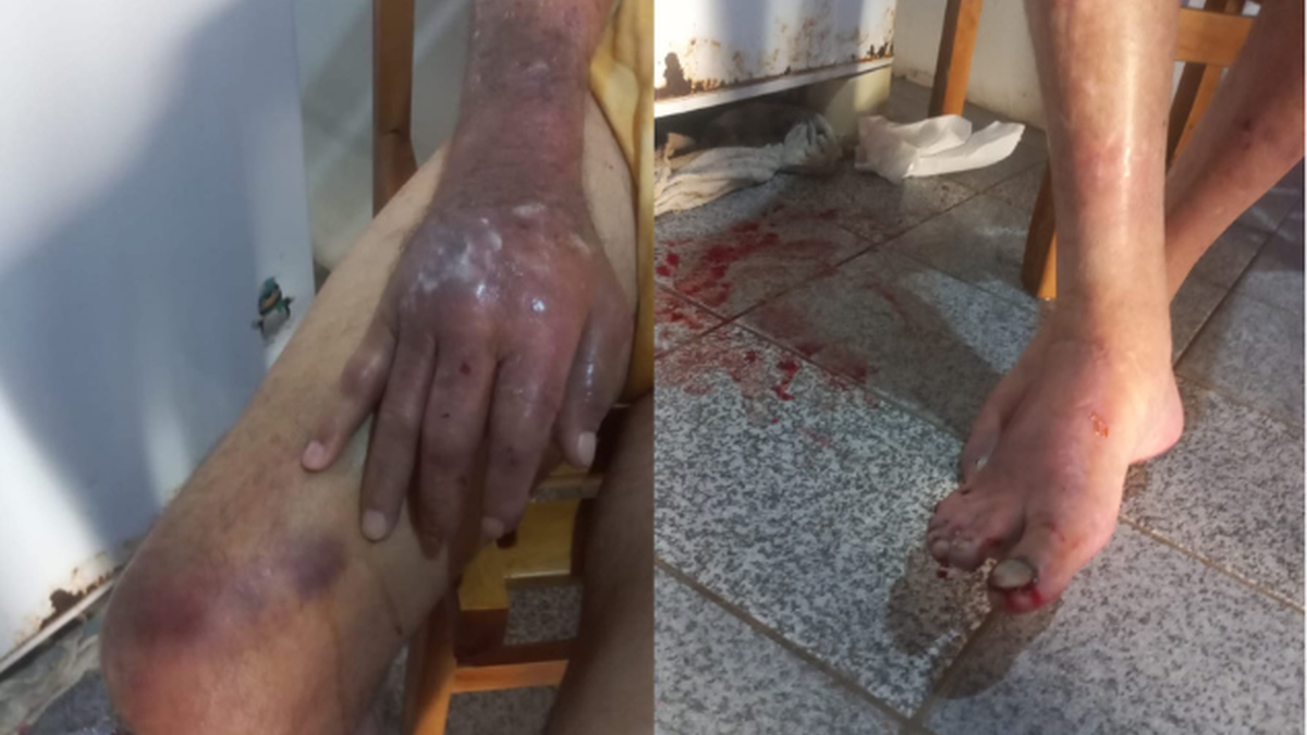 Filha é presa por maus-tratos após idoso ser encontrado ferido e em risco em Belo Monte