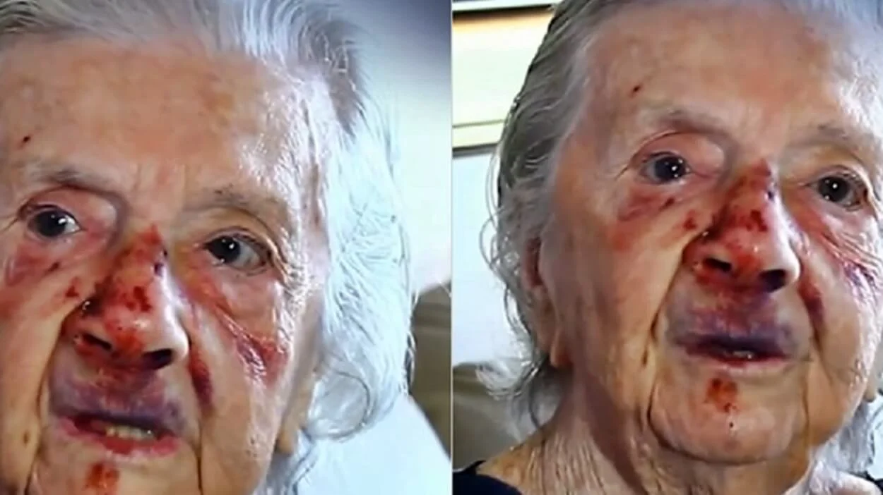 Idosa de 93 anos é agredida durante assalto