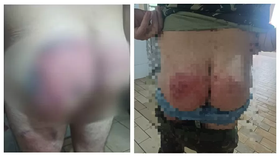 Exército expulsa 6 militares suspeitos de torturar e agredir soldado