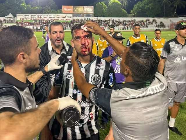  Allef, do ASA, foi atingido na testa por uma lata de fumaça colorida e sofreu corte na cabeça - Foto: Nasário Silva/Líder FM