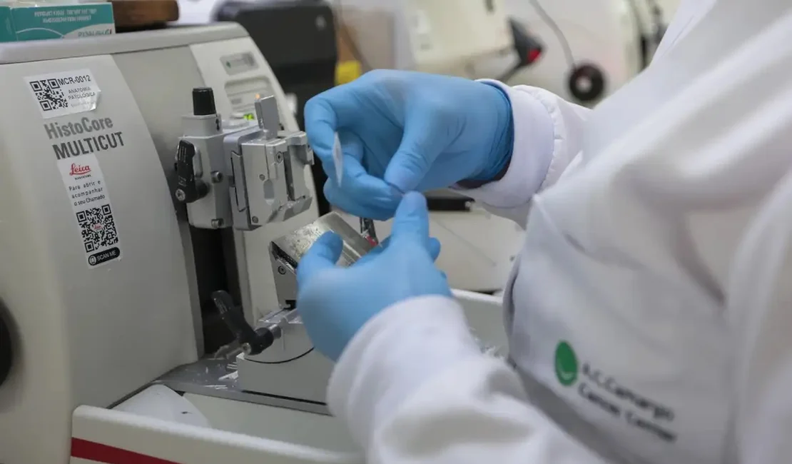 Cura de câncer de próstata pode chegar a até 98%