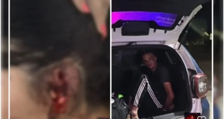 Ciúme canibal: mulher tem pedaço da orelha arrancado pelo marido