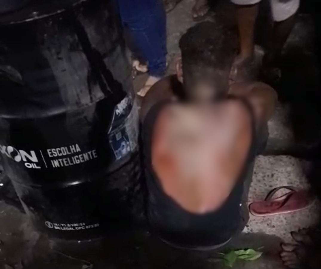  Homem foi queimado pela ex-companheira e Secretaria de Saúde busca familiares - Foto: Reprodução