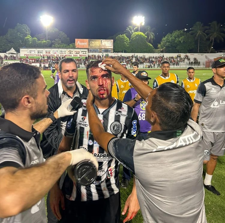 Jogador do ASA sofre corte na cabeça ao ser atingido por torcedor